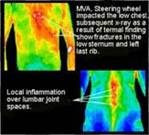 Thermography